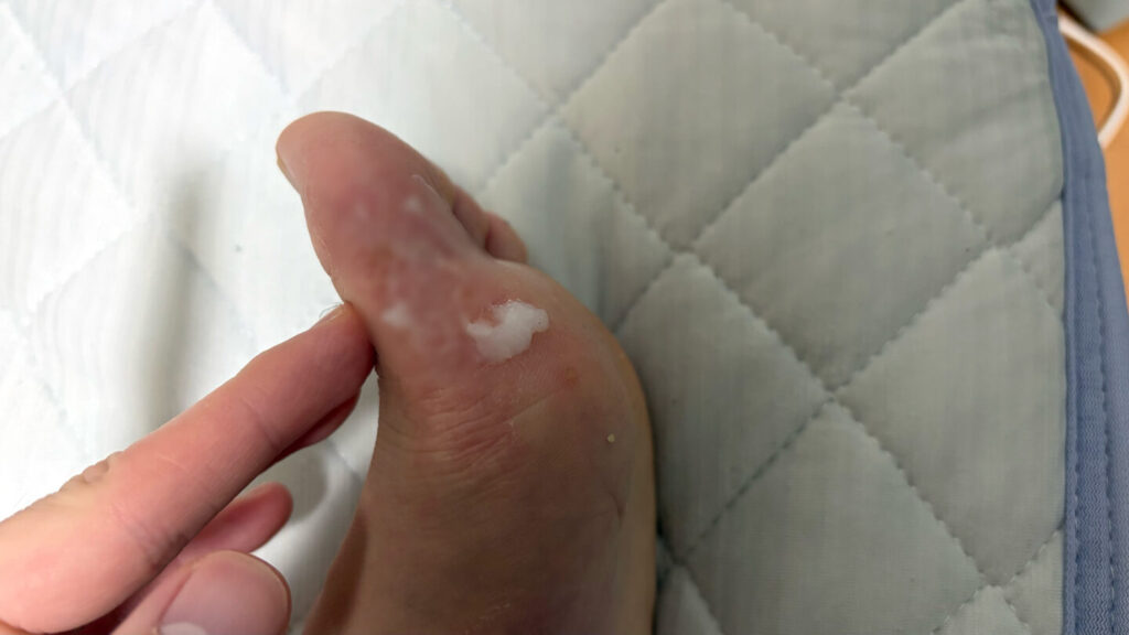 第35回ぐんまマラソン大会レポート|31らん(さいらん)