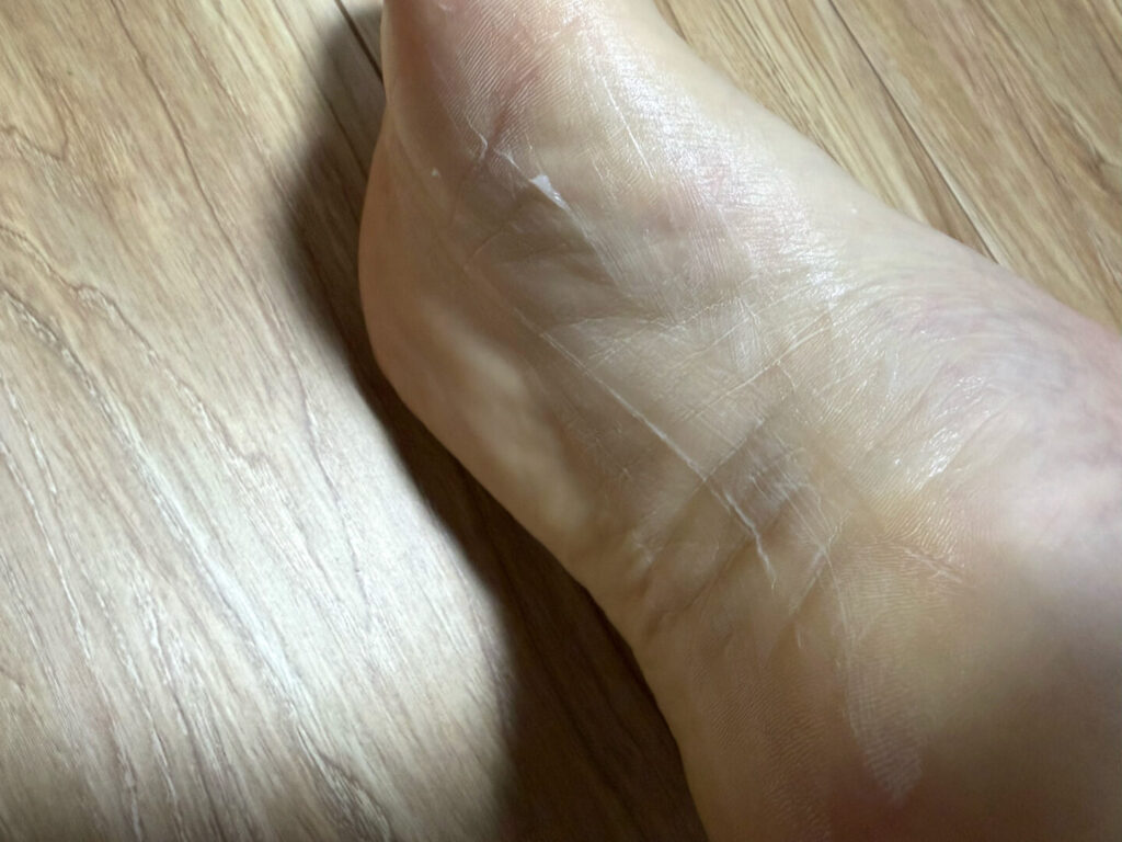 プロテクトJ1レビュー|31らん(さいらん)