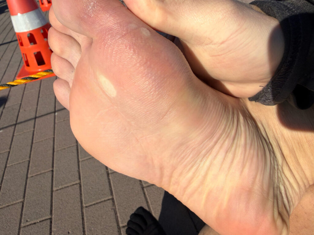 プロテクトJ1レビュー|31らん(さいらん)