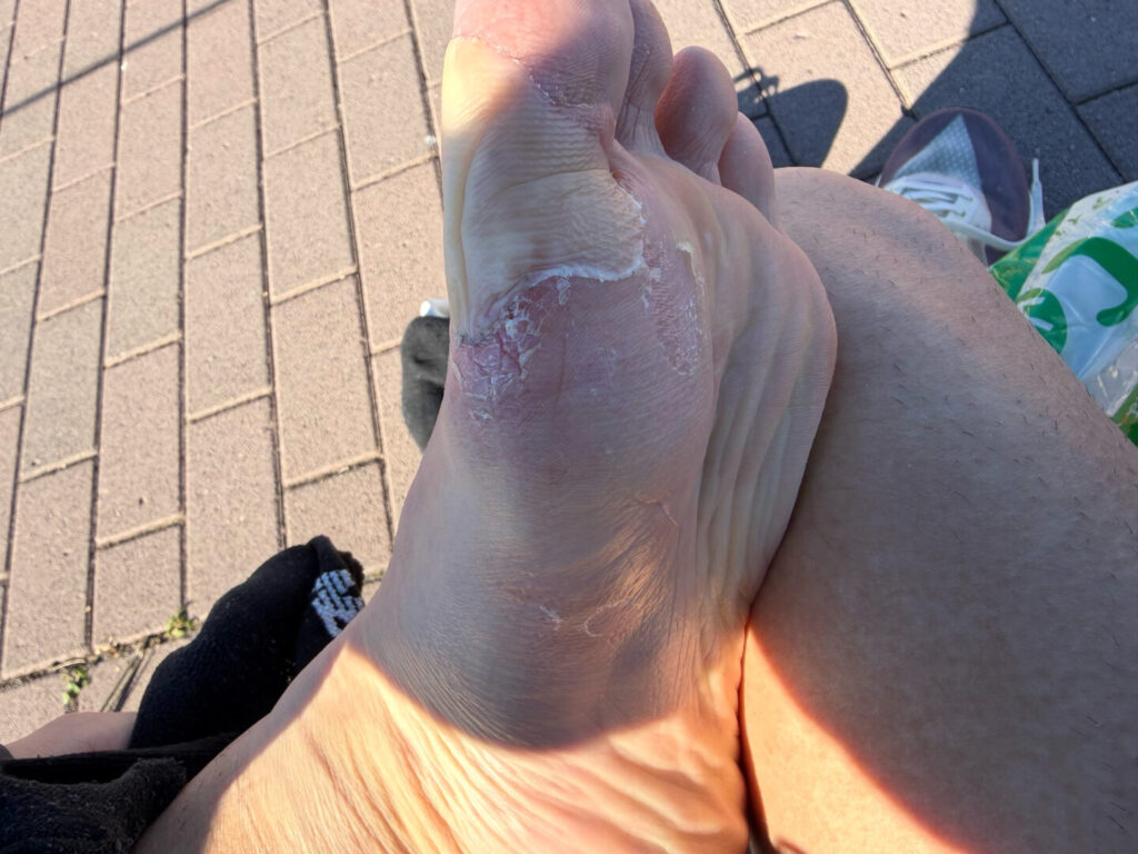 プロテクトJ1レビュー|31らん(さいらん)